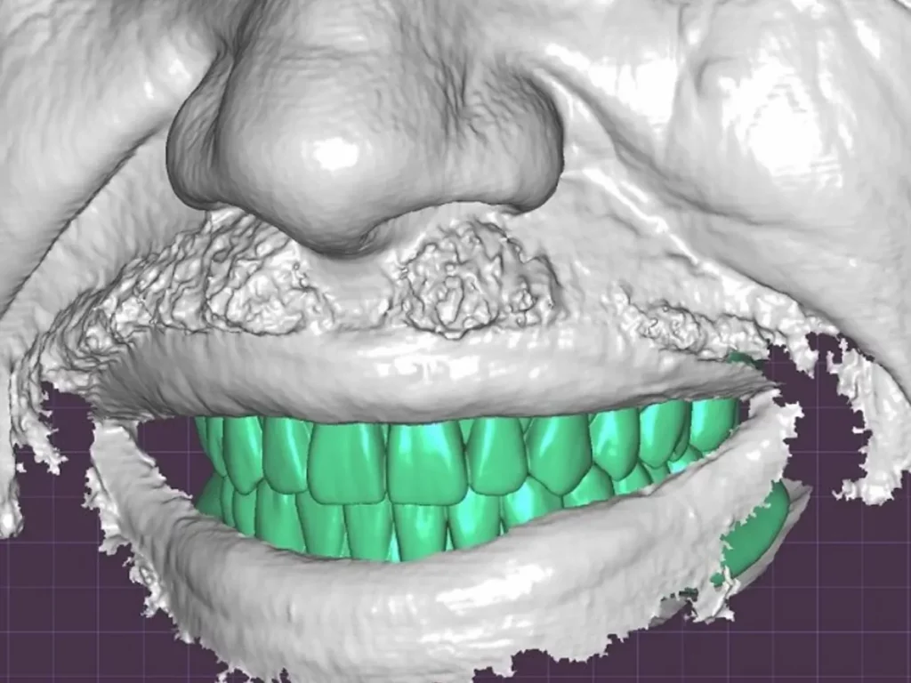 Dentales 3D-Modell